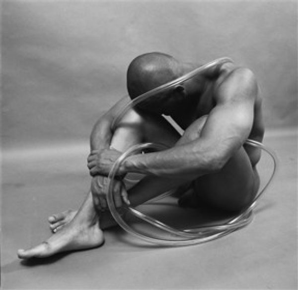 A black and white photograph of a naked man sat on the floor in a plain empty room. He tucks his face into his knees. He has clear plastic tubing curled around his body.